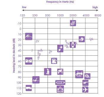 Audiogram